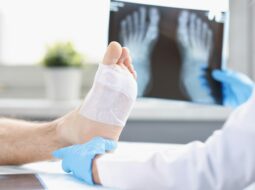 Evolution of orthopedic techniques